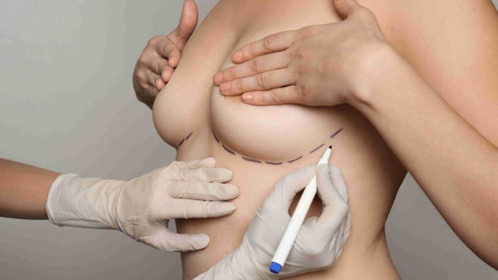 Chirurgie mammaire - remboursement - assurance maladie - mutuelles