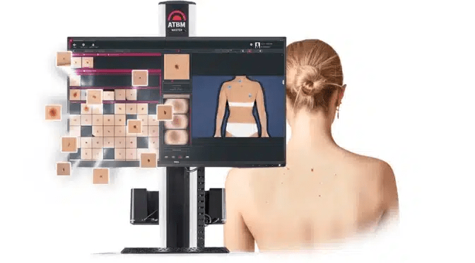 Les avantages de la dermatoscopie Fotofinder Gianfermi