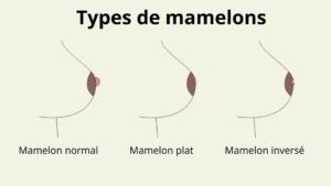 Types de mamelons