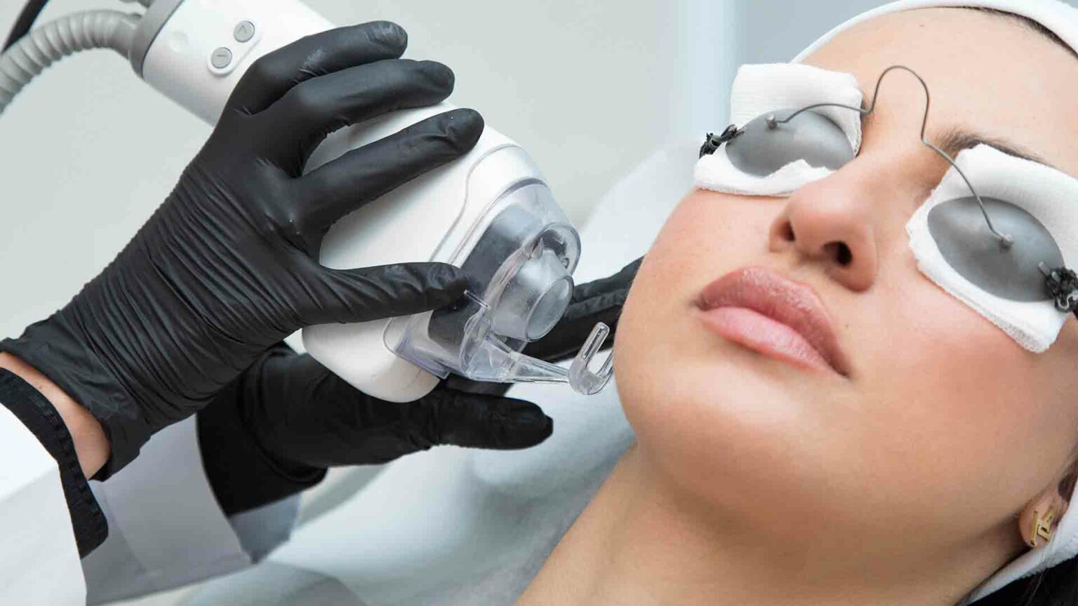 Laser CO2 docteur Gianfermi Paris