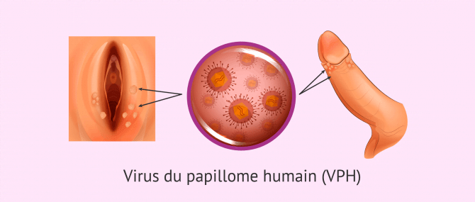 Papillomavirus humain (HPV) MST Gianfermi